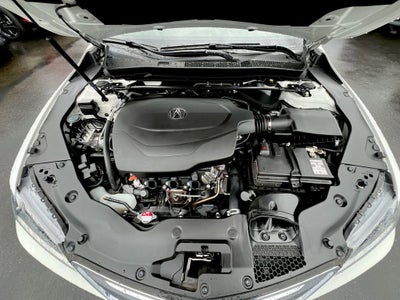 2017 Acura TLX w/Technology Package