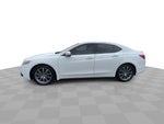 2017 Acura TLX w/Technology Package